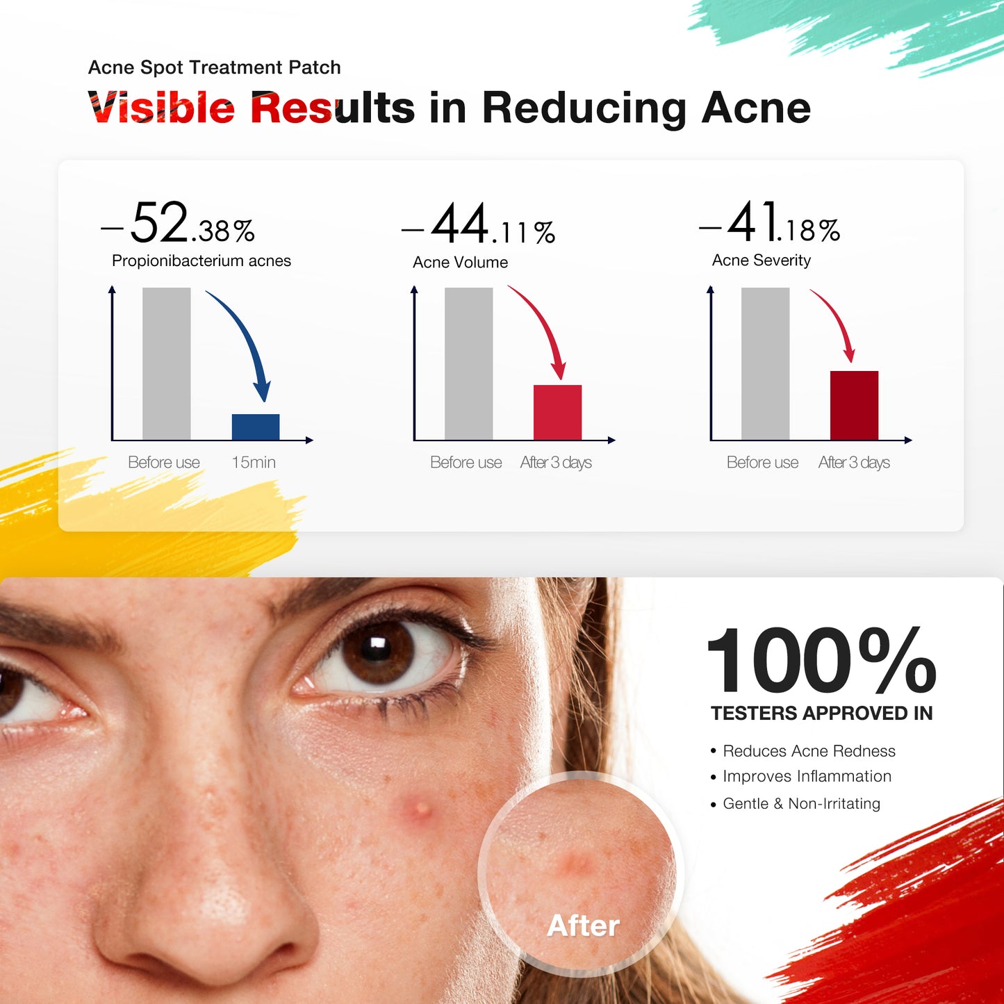 JOVS Acnebye LED Therapy Patch